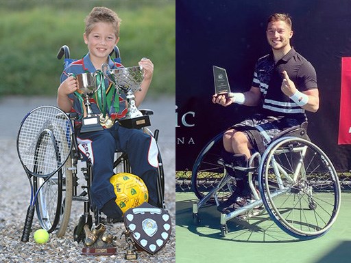 Alfie Hewett then and now (first image credit Eastern Daily Press Angela)